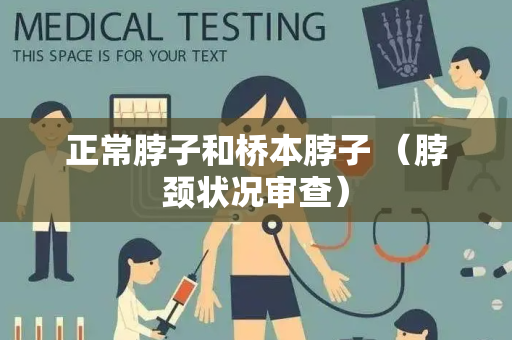 正常脖子和桥本脖子 （脖颈状况审查）